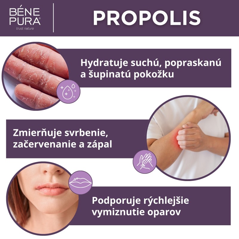 Masť na Svrbenie Pokožky s 30% Propolisom - 40ml