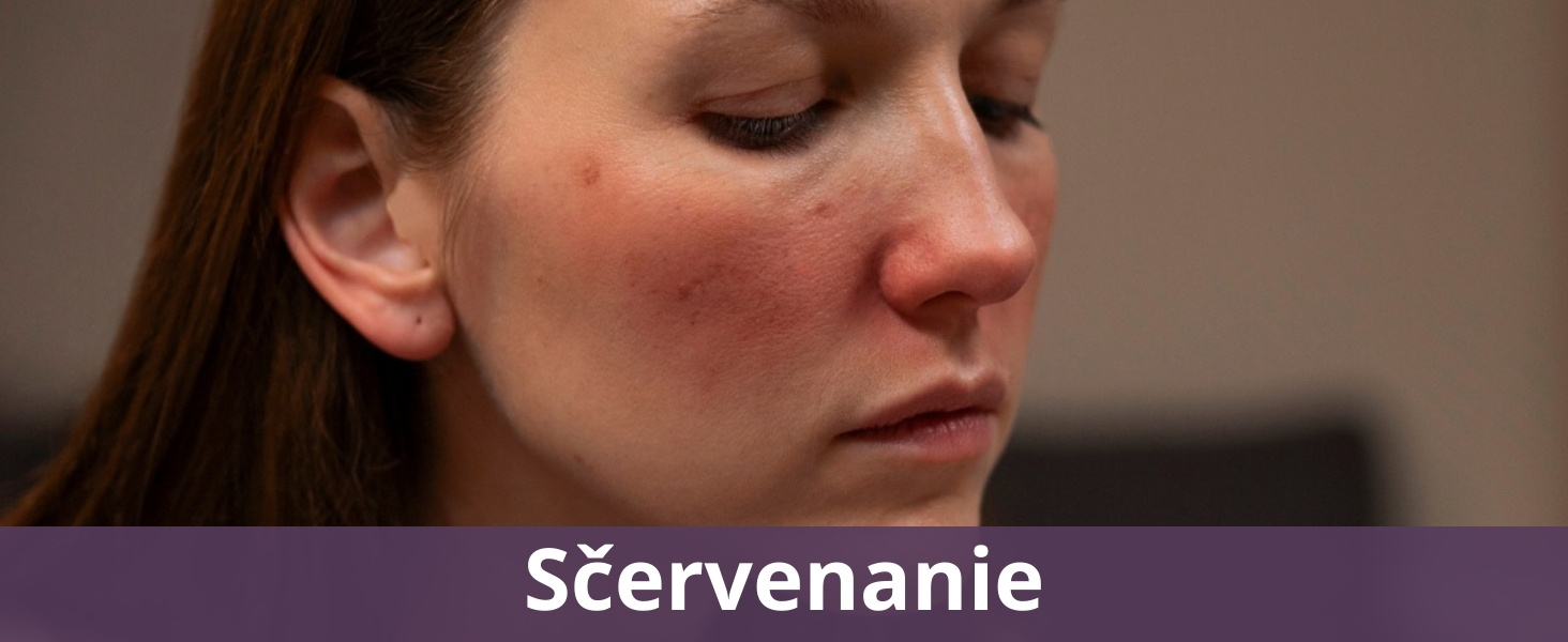 Sčervenanie