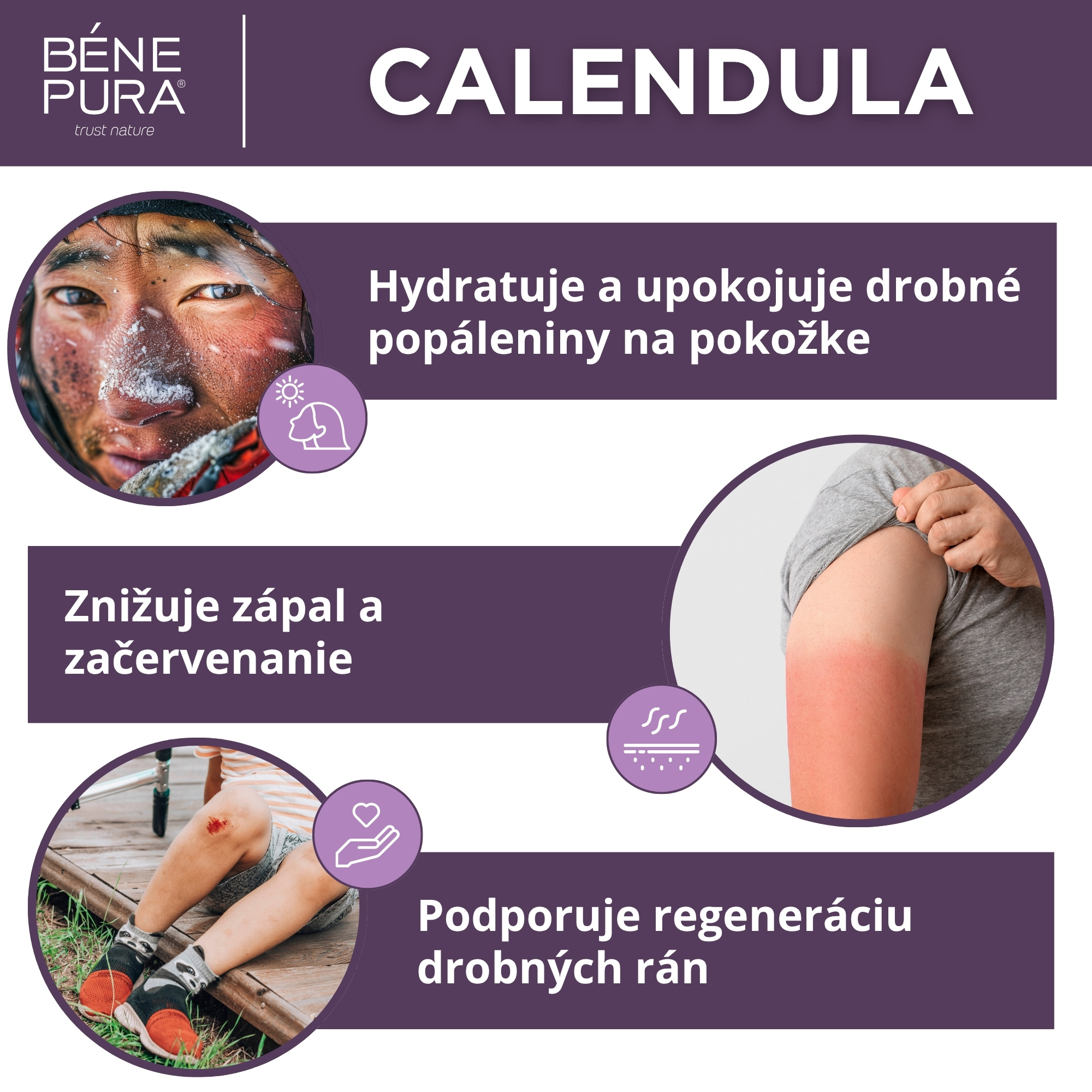 Sada "Masti na rany, popáleniny a svrbenie 2"